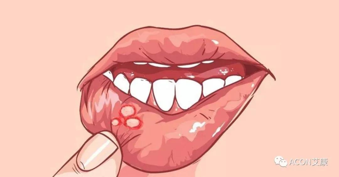 哪些小病容易讓人忽視，最后造成越拖越嚴(yán)重呢？