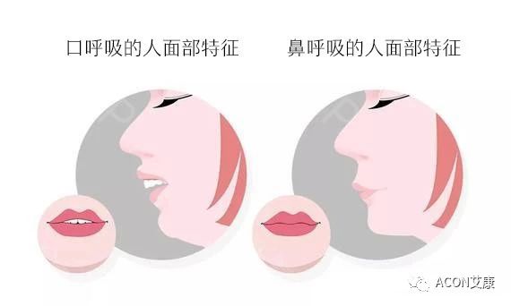 過敏性鼻炎會(huì)讓孩子變傻？！家長該如何應(yīng)對